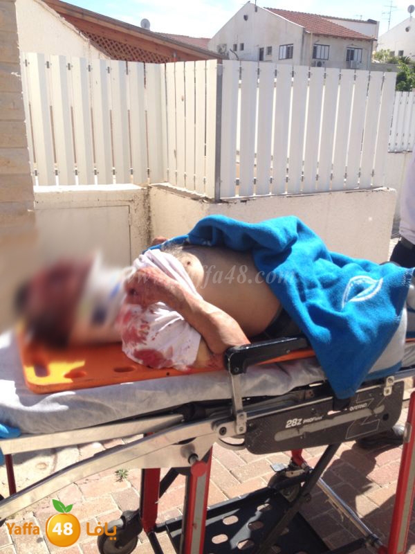 man injured ramla 0515 (4).JPG